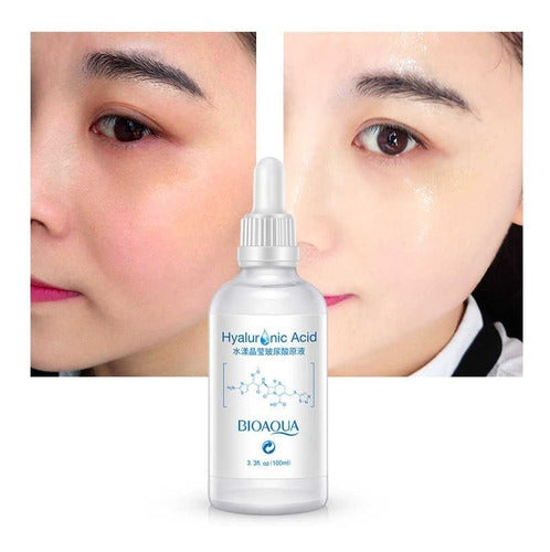 kit de acido hialuronico y vitamina c