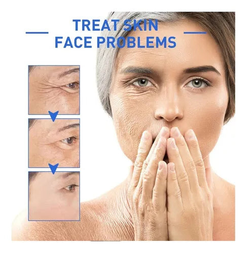 Botox Solution Anti edad Serúm