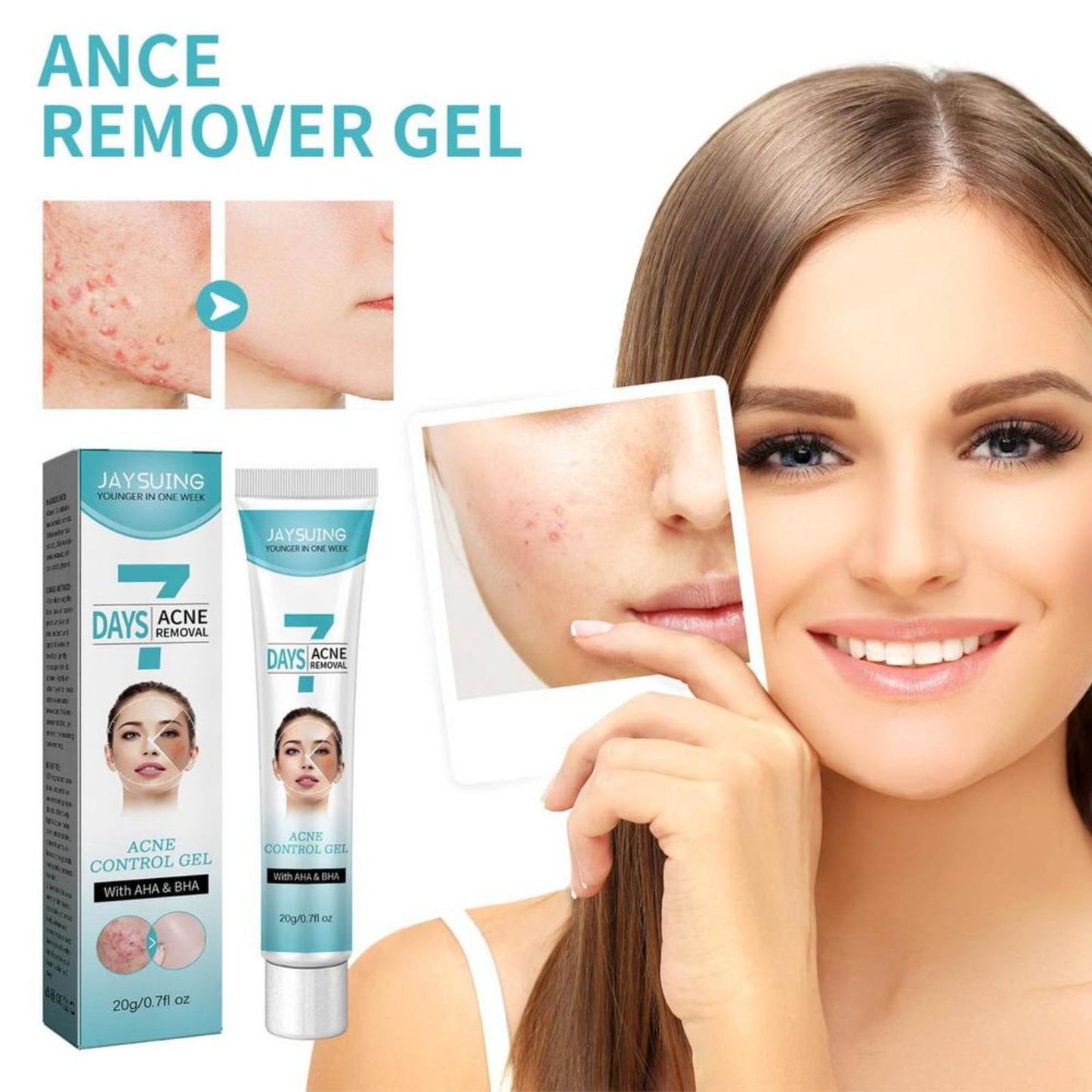 🧴Crema tratamiento acné mascarilla facial 🧴