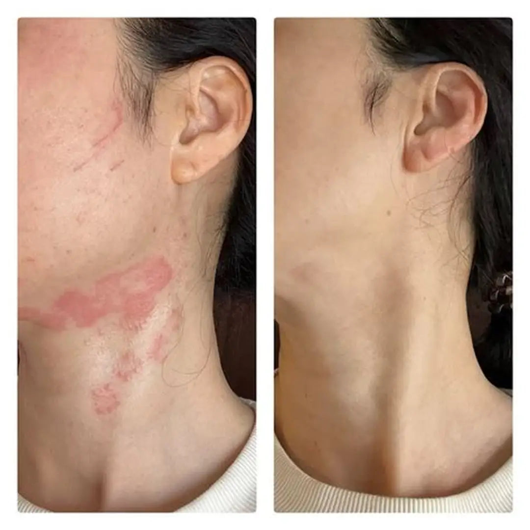 ✨CICATRIZANTE RENOVA spray ✨