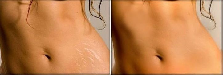 ✨CICATRIZANTE RENOVA spray ✨